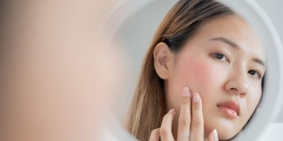 woman looking in the mirror struggling with alcoholic rosacea